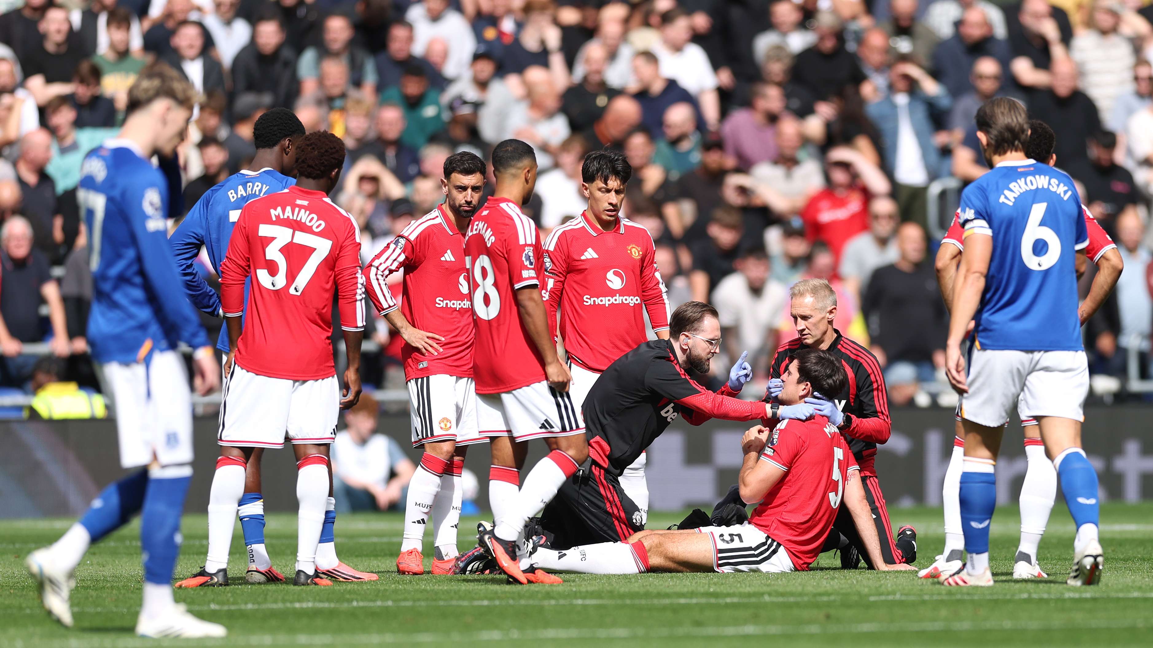 Maguire Suffers Bloodied Nose in Manchester United vs